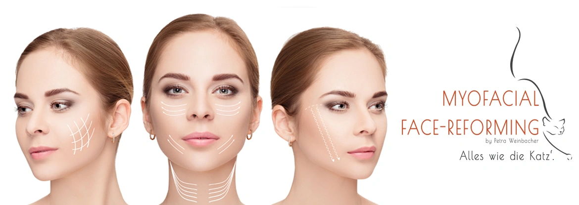 myofasziales Face-Re-Forming by Petra Weinbacher, Eggenfelden